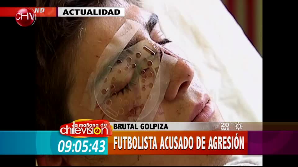 Sigue el juicio a futbolista que agredió a joven en discoteque