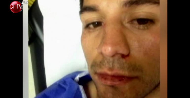 Edmundo Varas recibió golpiza que lo dejó en la clínica