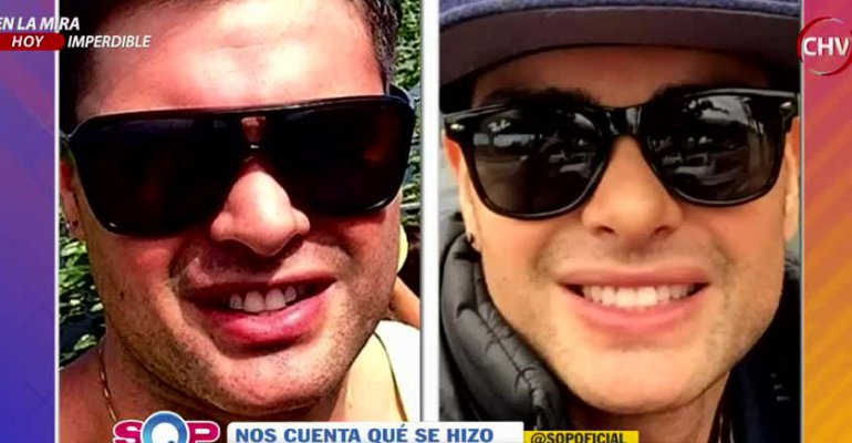 Sigue haciendo noticia: Nelson Mauri viajó a Perú para arreglarse una cirugía mal hecha