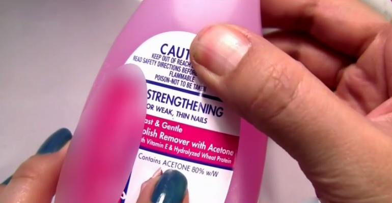 Mujer se quemó al prender cigarro y tener sus manos con acetona