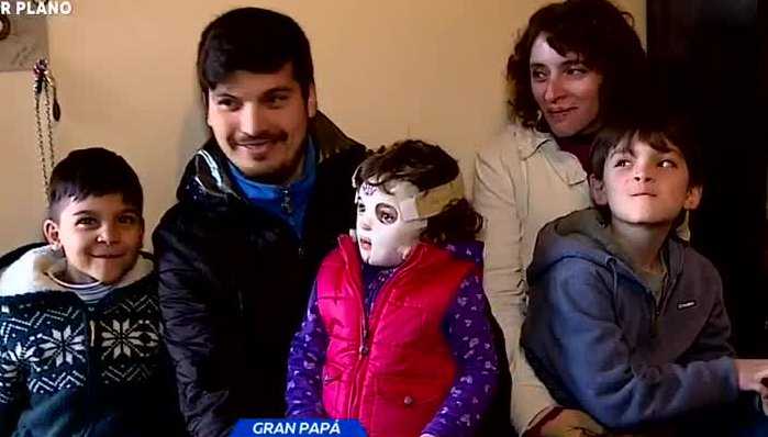Papá dejó de trabajar para cuidar a su familia que se quemó - Parte 2