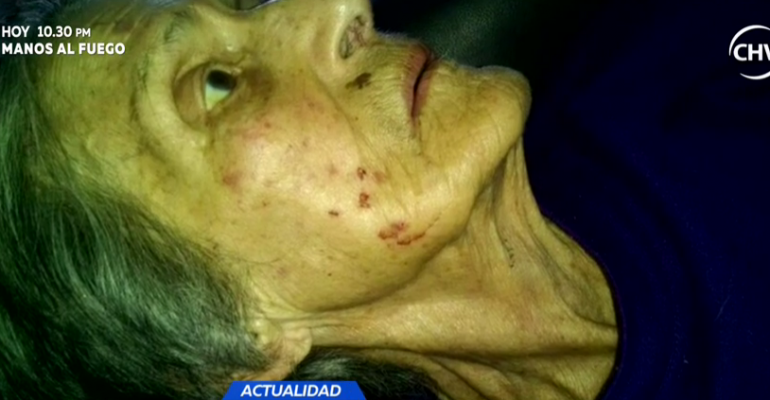 Denuncian maltrato a abuelita por parte de su hija