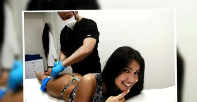 Fran Undurraga recurrió a hilos revitalizantes para su cola