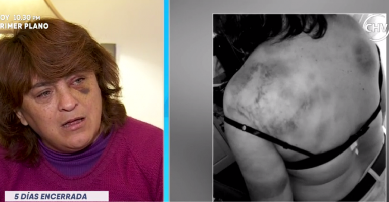 Crudo testimonio de mujer que fue torturada por su pareja - Parte 2