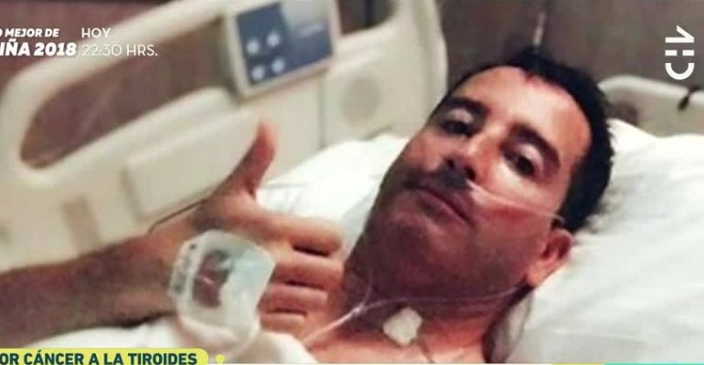 Eduardo Fuentes habló tras su operación de tiroides