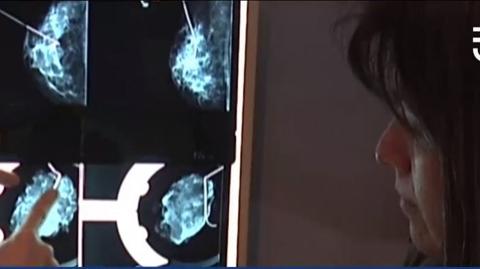 Urgente llamado a chilenas para realizarse autoexamen e identificar la presencia de cáncer de mama en forma oportuna
