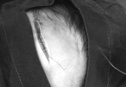 Médico publicó el profundo corte que hilo curado dejó en la frente de una niña de 9 años