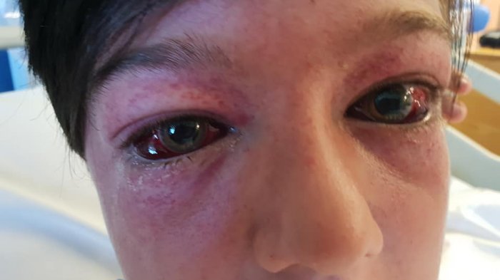 No es broma: La espeluznante razón para evitar un absurdo reto viral de Internet