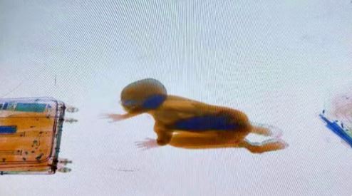 Trabajadores se llevaron el susto de sus vidas al ver a un niño a través de la máquina de rayos X