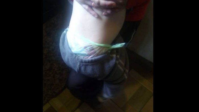 La dramática historia de un bebé que ocupa bolsas plásticas y trapos como pañales