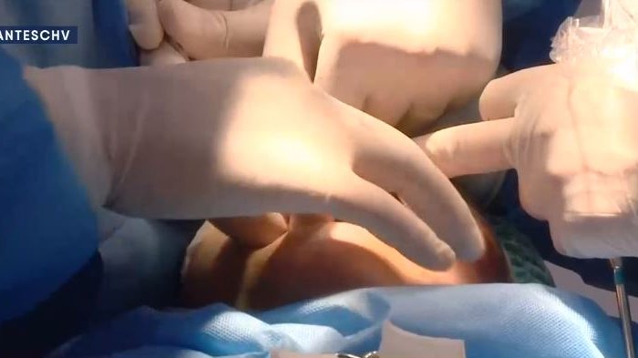 El boom de los implantes sin ley: Pusimos a prueba el registro de especialidades