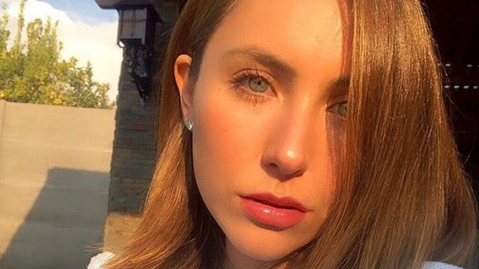 Ángela Duarte anunció que se realizará cirugía plástica