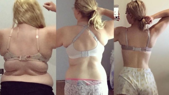 “No más la gorda Josie”: El increíble cambio de joven que bajó 63 kilos por el bullying que recibía en su colegio