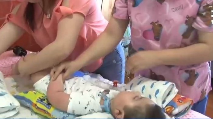 $500 millones al año: Corte Suprema ordenó a Fonasa financiar costoso medicamento para niño con grave enfermedad