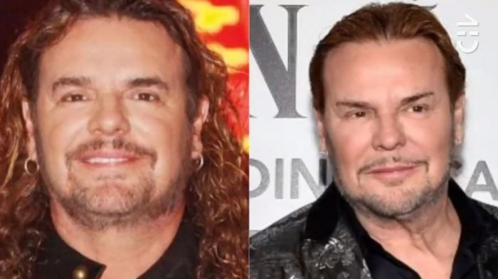 Encuentre las 5 diferencias: Burlas y criticas generó la cirugía facial que lució el cantante de Maná en los Grammy