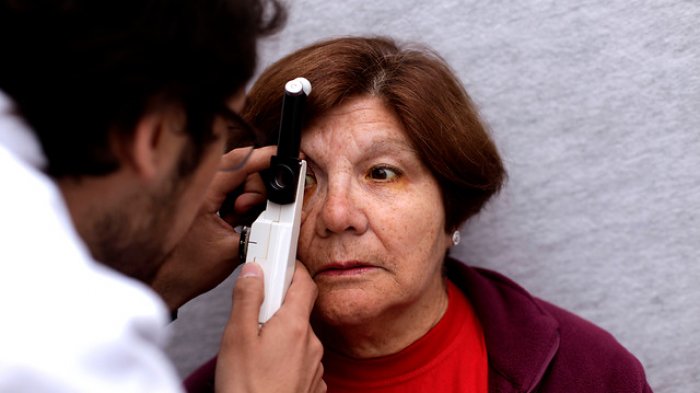 Oftalmólogos se oponen a la decisión: Tribunal constitucional autorizó entrega de recetas en ópticas