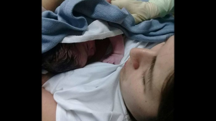 Por qué los casos de mujeres defecando por la vagina son más comunes de lo que se piensa