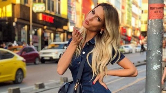 Gala Caldirola se llena de críticas por retoque en su boca