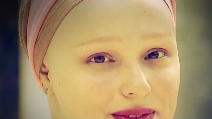 Una lucha por recuperar la femeneidad: ¿Cómo viven las mujeres con alopecia?