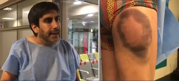 Doble de Rafael Araneda sufrió violento robo en Las Condes