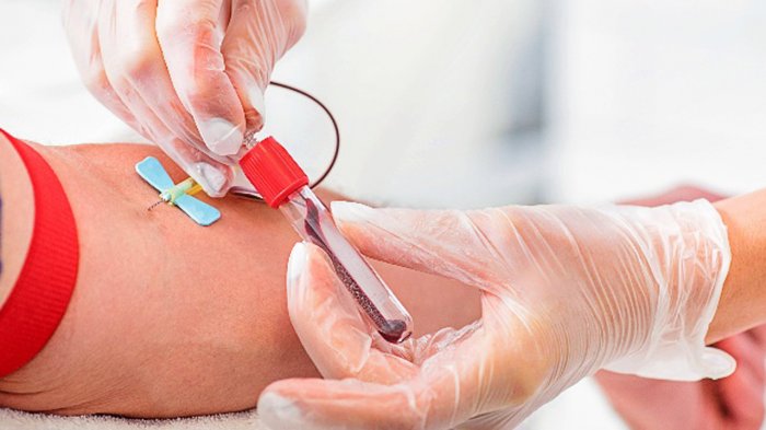 Histórico peak de casos de VIH en Chile: Más de 6 mil casos fueron diagnosticados en el 2018