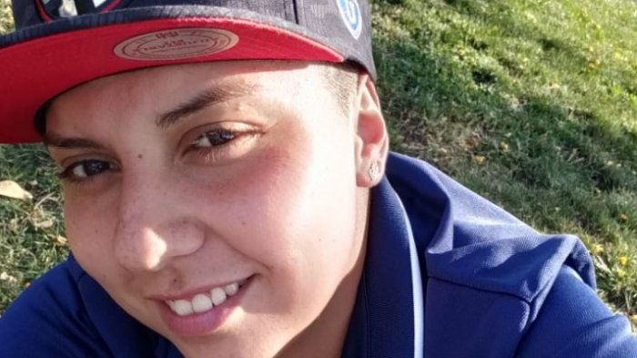 Fractura de cráneo y hemorragia interna: Joven lesbiana está grave tras sufrir violenta agresión homofóbica