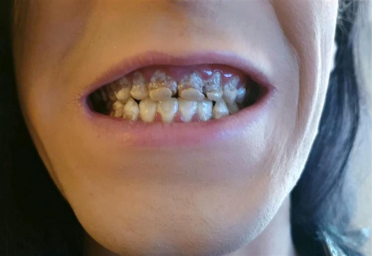 Imagen foto_00000015