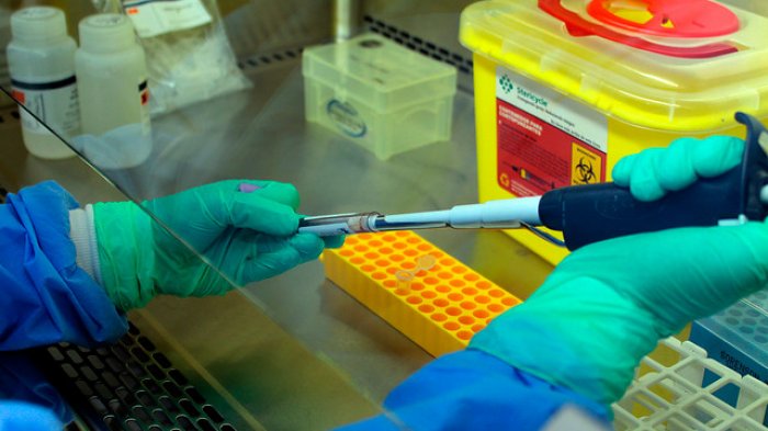 Guagua de 25 días contrajo el virus Hanta: 