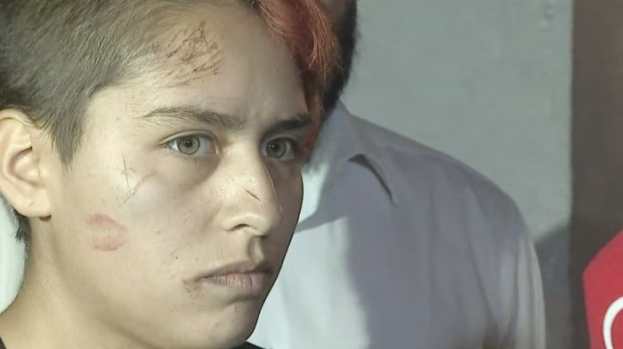 Habla joven trans que sufrió agresión en la comuna de Pedro Aguirre Cerda: 