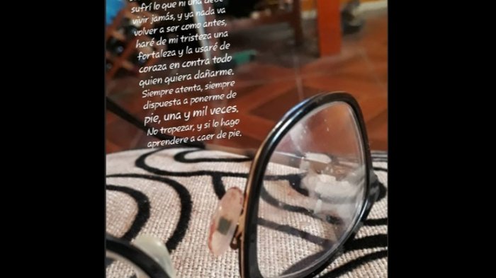 “Él solo paró cuando se cansó de golpearme”: Joven quedó desfigurada y acusa femicidio frustrado en Angol