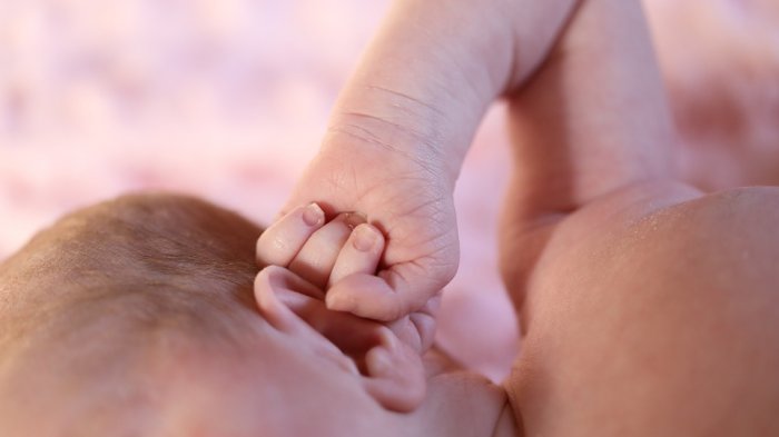 Nace una bebé con el corazón fuera del tórax en Bolivia