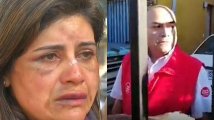 Mujer que sufrió brutal golpiza de su pareja en Temuco: 