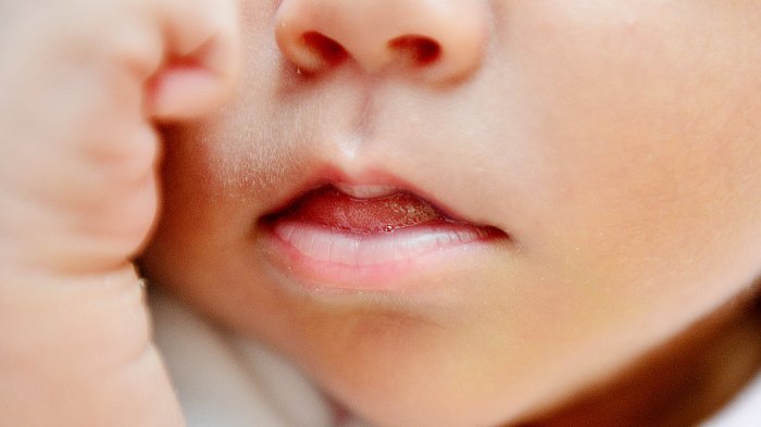 Niño de 1 año y 7 meses quedó internado tras comerse un pito de marihuana: Los padres serán investigados