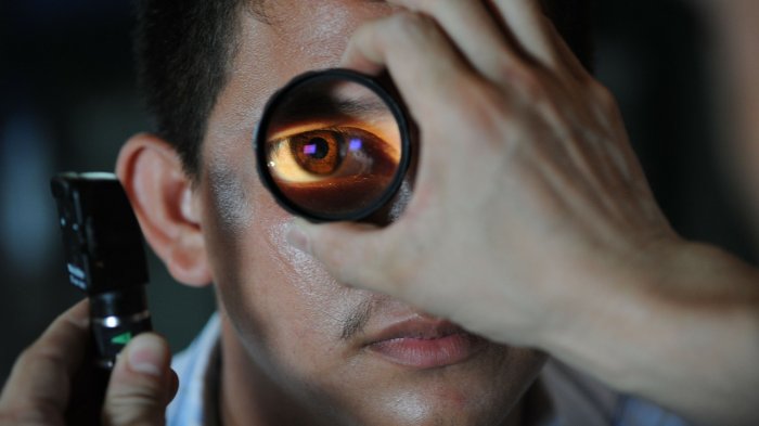 ¿Cómo prevenir el glaucoma, la principal causa de ceguera irreversible en el mundo?