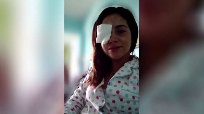 Le extirparon un ojo por cáncer y ahora realizarán un bingo para costear el tratamiento que le puede salvar la vida