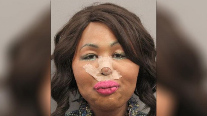 Detienen a ladrona serial que robaba bancos para hacerse cirugías