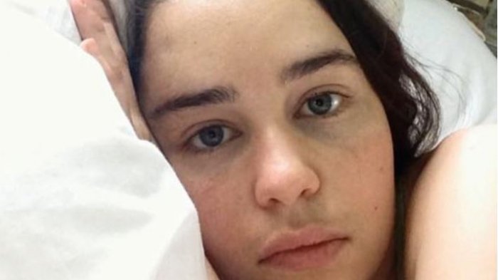 Emilia Clarke comparte fotos íntimas del tratamiento al que se sometió por aneurisma cerebral en rodaje de GoT