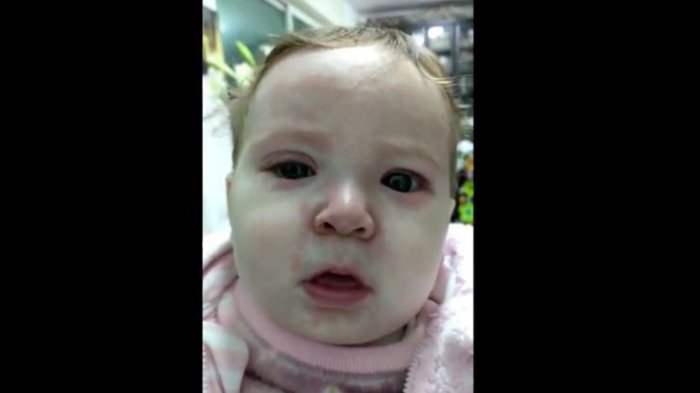 Los expertos apuntan a los anti-vacunas: Bebé de meses de vida contrajo sarampión y tuvieron que hospitalizarla