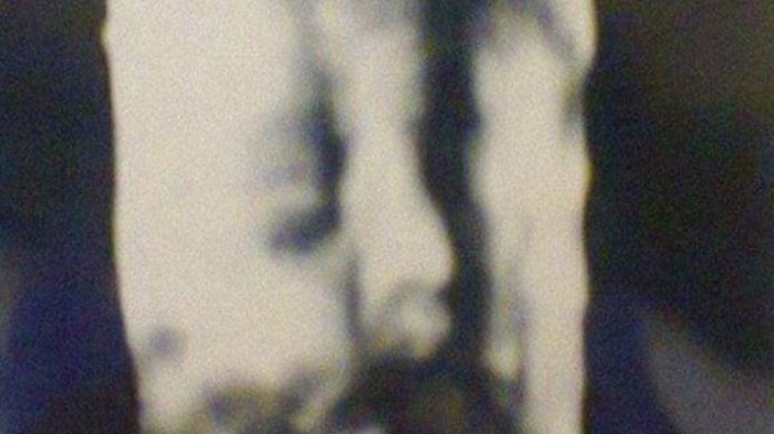 Mujer denuncia que doctor le entregó la misma ecografía que había pasado a otra paciente embarazada