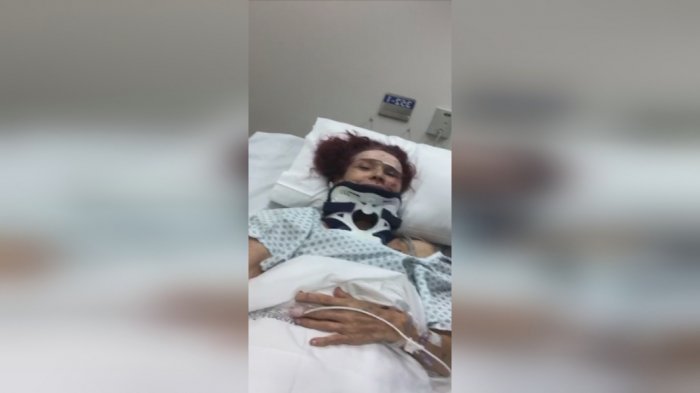 Shlomit Baytelman fue operada tras ser atropellada por un ciclista: “Estoy mucho peor de lo que pensaba”