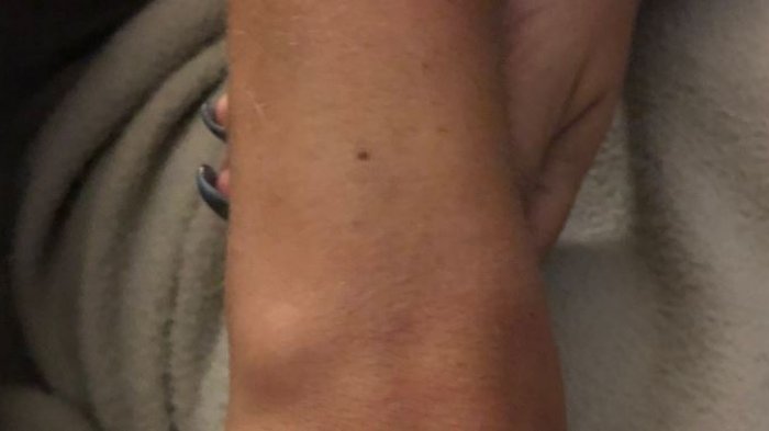 ¿Tú también? Este es el lunar que miles de mujeres tienen en el mismo lugar