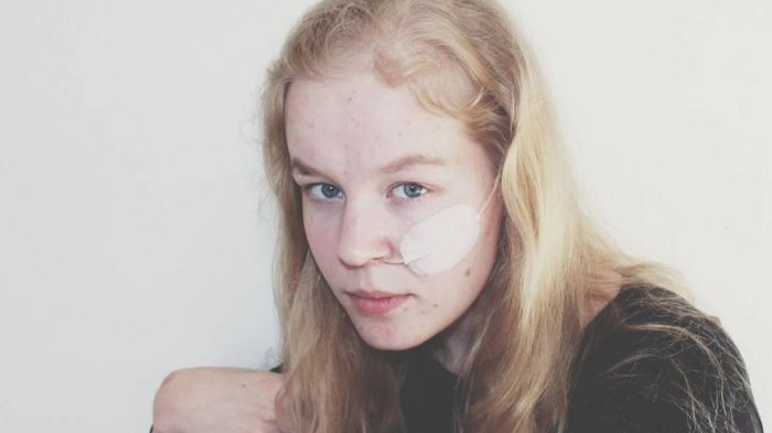 Holanda concedió eutanasia a adolescente con depresión que fue víctima de abuso y violación: 