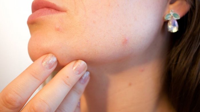 Ojo con la calefacción y los cambios de temperatura: 5 efectivos consejos para cuidar tu piel en invierno