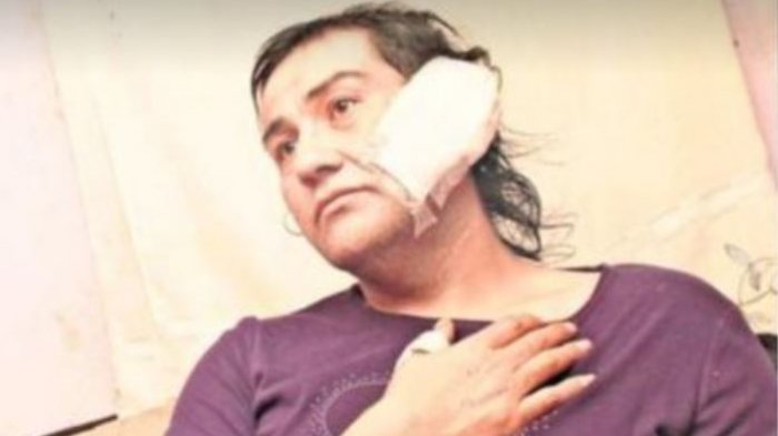 Movilh denuncia ataque transfóbico con machete contra mujer que hizo dedo en Ñuble