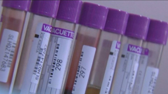 71 mil personas viven con VIH: Chile lidera tasa de nuevos contagios