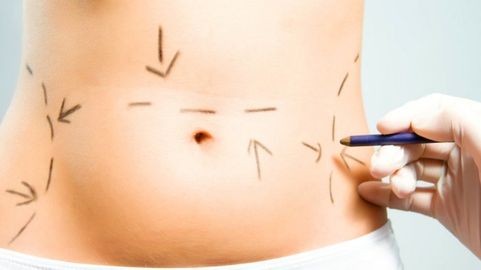 Diputado propone que chilenos tengan acceso a cirugía plástica gratuita hasta una vez en la vida