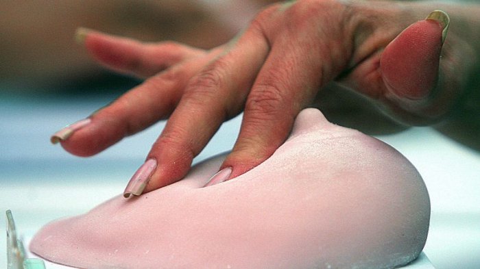 ¿Puede aumentar el riesgo de cáncer mamario si me someto a un implante?