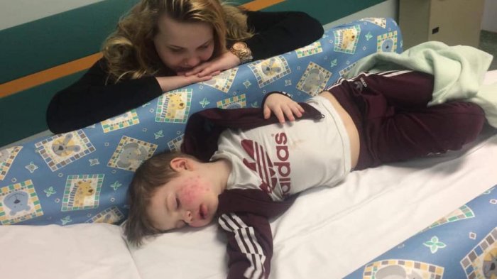 Madre relató cómo su hijo de 3 años casi quedó ciego tras contagiarse herpes por un beso