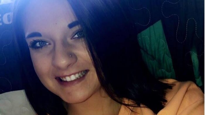 Joven denuncia que se le cayó el pelo tras aplicarse bálsamo: Creen que lo mezclaron con crema depilatoria