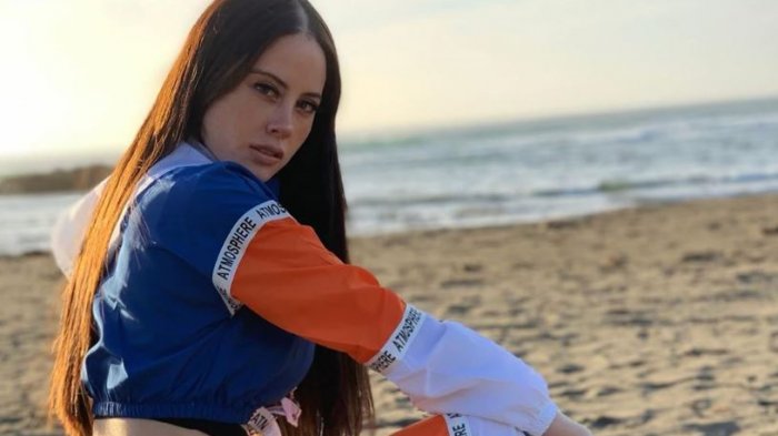 El drama de Ignacia Michelson: Le inyectaron metacril en sus glúteos